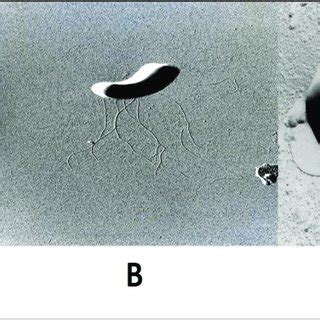 Les Types De Flagellation A Micrographie Lectronique Balayage De