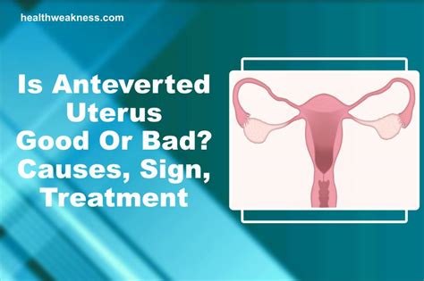 Is Anteverted Uterus Good Or Bad? Causes, Sign, Treatment (2024)