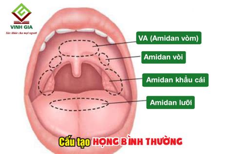 Hình ảnh viêm họng chi tiết nhất và họng bình thường