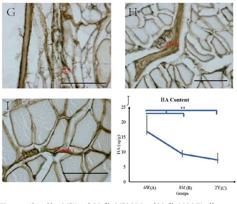 Figure 1 From The Effects Of Aging On The Intramuscular Connective