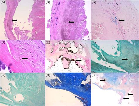 Hematoxylin And Eosin Hande Stain At 10× A And 20× Magnification B