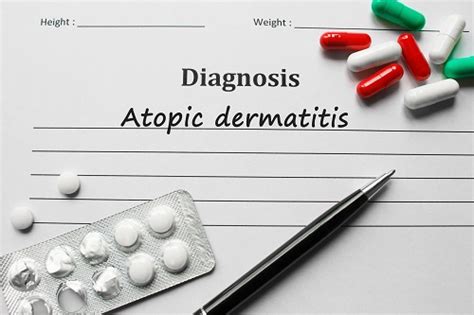 Guideline For Diagnosis And Assessment Of Atopic Dermatitis Eczema