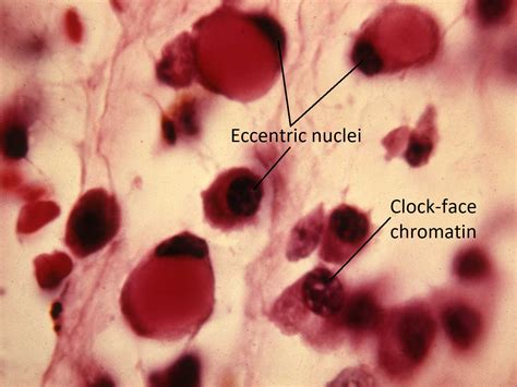 Moran Core Cellular Histopathology