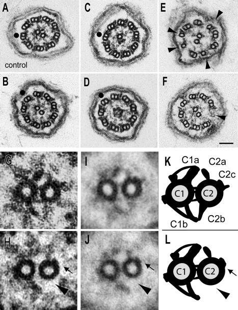 Flagella Of HY3 RNAi Cells Lack The C2b Projection And Part Of The C2c