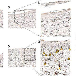 Representative Images Of Immunohistochemistry Staining For Pseudomonas