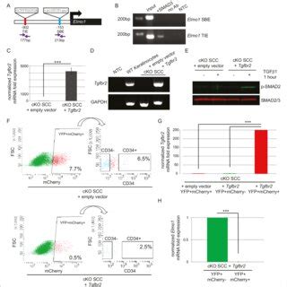 Knockdown of Elmo1 in vitro affects cell migration. (A) shRNA knockdown ...