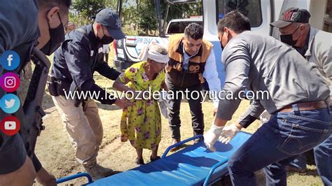 Mujer Resulta Lesionada Tras Ser Atropellada En La M Xico Tampico