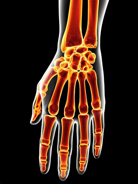 Human Hand Bones #6 by Sciepro