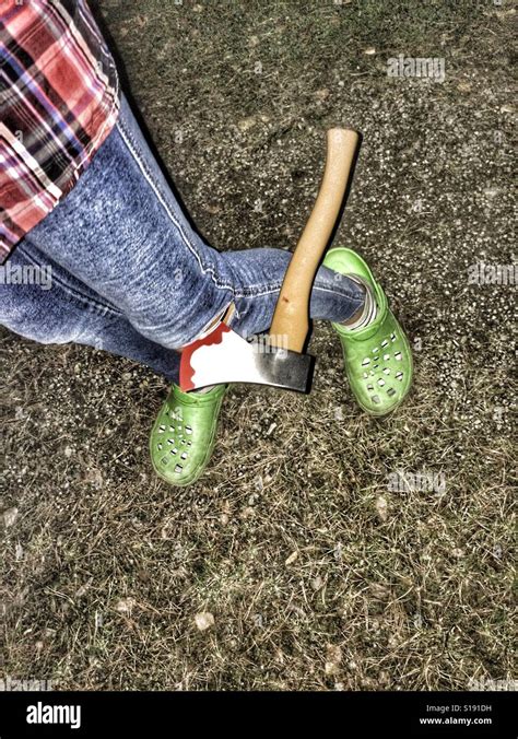 Ax In Leg Of Person Stock Photo Alamy