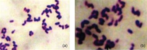 Gram stain of Corynebacterium pseudotuberculosis from caseous... | Download Scientific Diagram