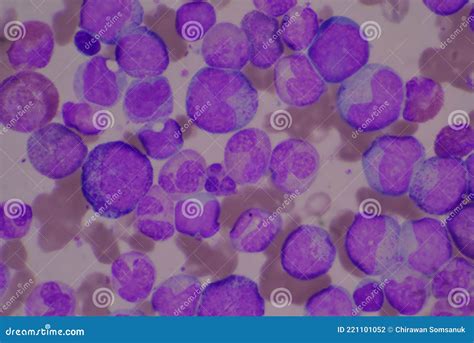 Immature And Mature White Blood Cells Stock Photo Image Of Diagnosis