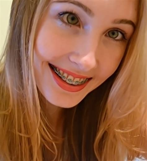Pin By Richard Pretty On Cute Adult Braces Wearers Braces Girls Perfect Teeth Blonde Hair Girl