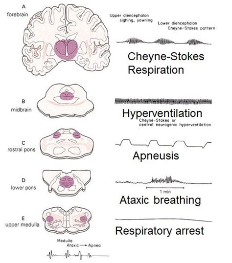 Types Of Abnormal Breathing Patterns