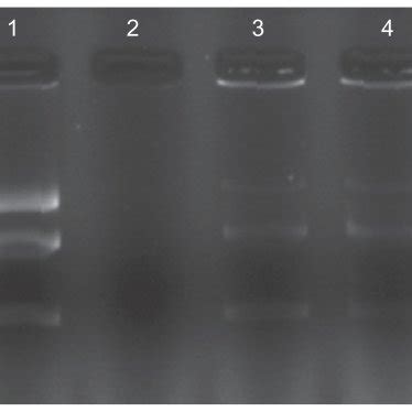 Protection And Release Assay Of Dna Lane Represents Naked