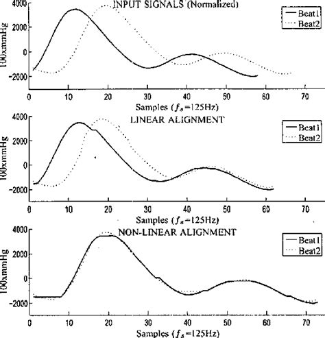 Figure 1 From Morphology Analysis Of Intracranial Pressure Using