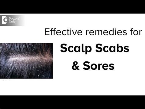 Medication For Scalp Sores