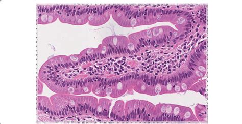 Human Duodenum Histology