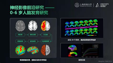 沈定刚教授：医学影像人工智能的创新应用与发展前沿 动脉网