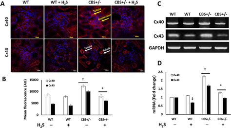 H S Downregulates Hhcy Induced Increased Expression Of Connexin