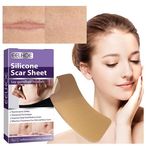 Soothing Purifying Hydrating＆moisturizing Silicone Fade Stretch Marks Cesarean Scar Hyperplasia