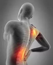 Myofascial Pain | Spine Experts in Dallas, Plano & Frisco, TX