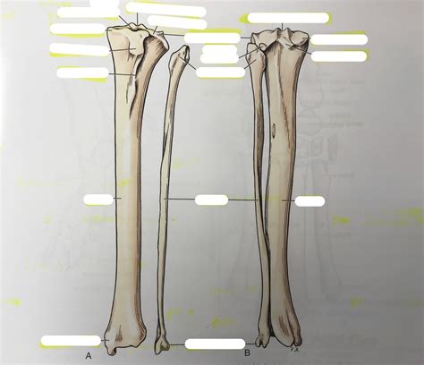 Exam Osteology Tibia Fibula Diagram Quizlet