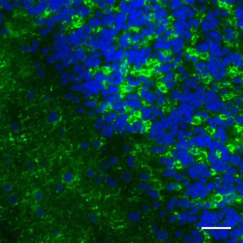 Gad65 Antibody Anti Human Readye Lease™ Miltenyi Biotec Usa