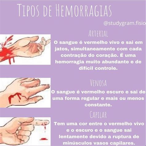 Tipos De Hemorragias Fisioterapia