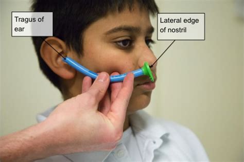 Nasopharyngeal Airway Measurement