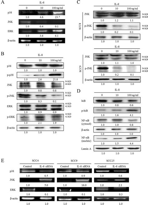 Activation Of P38 Mapkerk Nf κb Pathway And Reduction Of Jnk