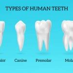 Gum Disease Stages Teeth Infographic Stock Vector Image By Annyart