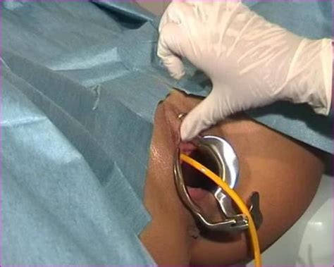 Medical Fetish Gyno Exam Anal Vaginal Exam Enema Page Intporn Forums