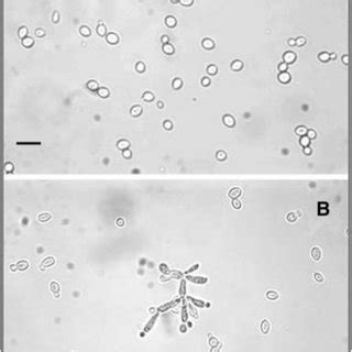 Cell Morphology Of Yeast Strains A Yeast Like Growth Of Turbo S