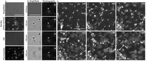 Time Lapse Ptychographic Phase Imaging Of Primary Rat Hippocampal