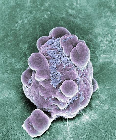 Cancer cell apoptosis, SEM - Stock Image - M132/0906 - Science Photo ...