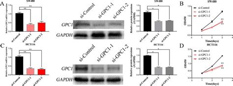 Silencing Gpc1 Inhibits Crc Cell Proliferation A C Crc Cell Lines