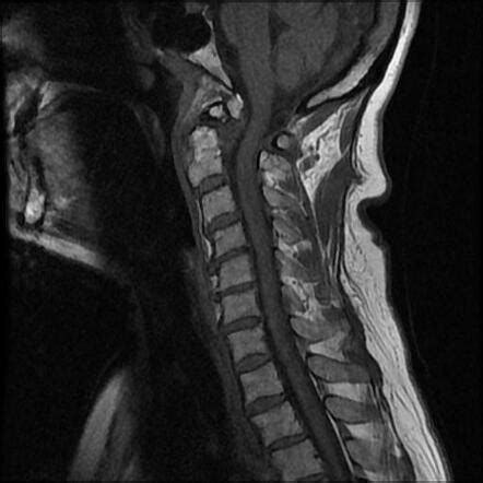 Radiology Quiz 99002 Radiopaedia Org