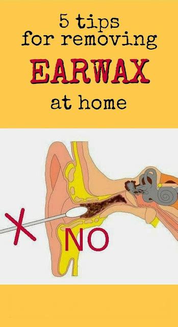 How To Safely And Properly Remove Earwax At Home Tips And What To