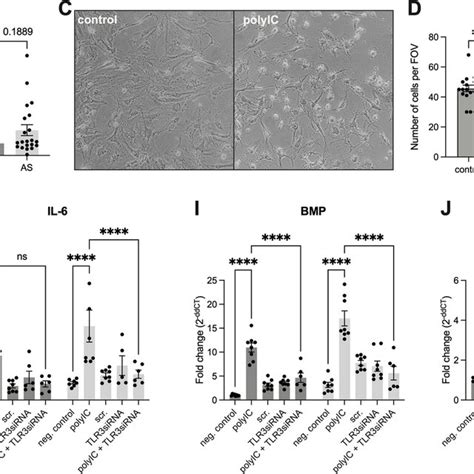 Tlr3 Is Expressed In Human Aortic Valves And Tlr3 Stimulation Activates