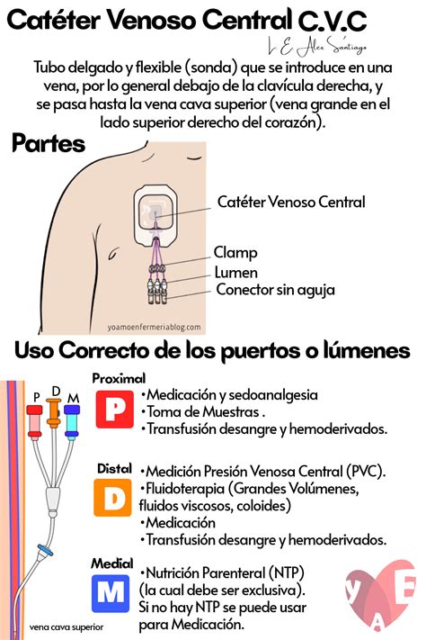 Cat Ter Venoso Central Cvc