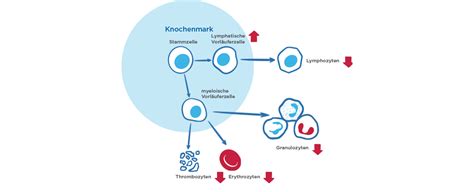 Akute Lymphatische Leuk Mie Was Ist Das Genau