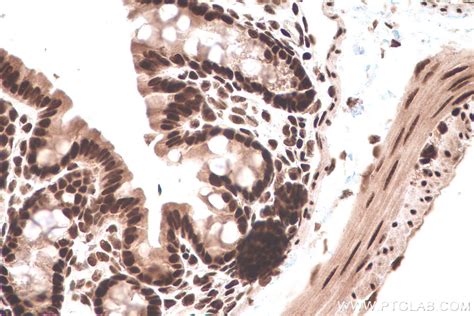 IHCeasy LSM8 Ready To Use IHC Kit KHC0827 Proteintech 武汉三鹰生物技术有限公司