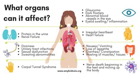 For Patients: What is amyloid? | SCAN-MP