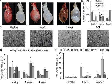 Abstract Alterations To The Extracellular Matrix Composition