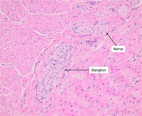 Small And Large Intestine Histology, 53% OFF