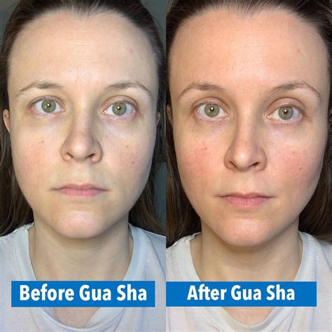 Gua Sha Before And After