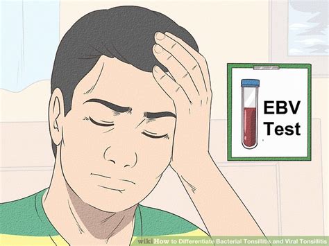 3 Ways To Differentiate Bacterial Tonsillitis And Viral Tonsillitis