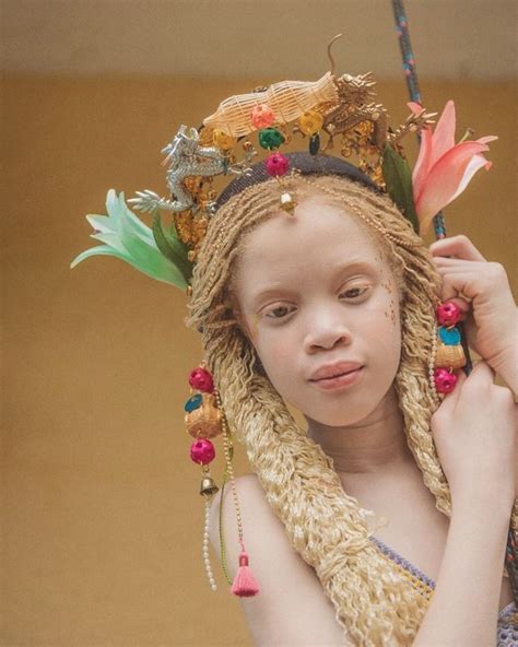 Visita Il Nostro Sito Albinism Black Royalty