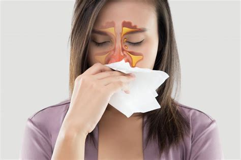 Causes Of Sinusitis Florida Ear Nose Throat Facial Plastic Surgery