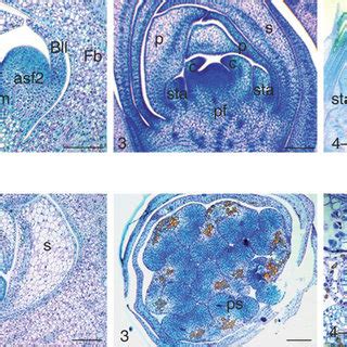 Key Stages Of Pistillate Upper Panel And Staminate Lower Panel